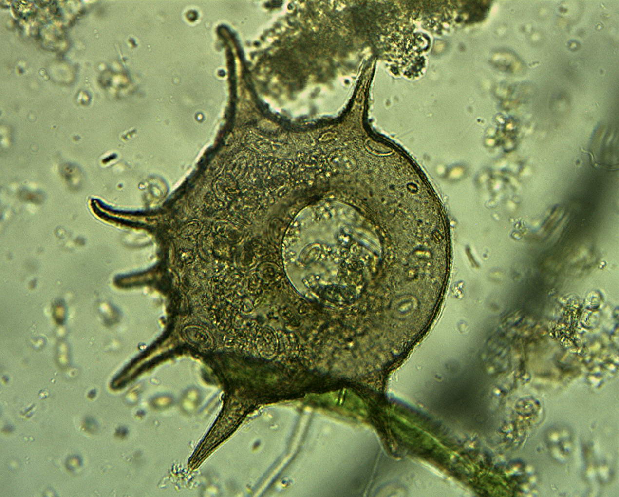 Centropyxis sp.